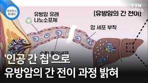 간킵